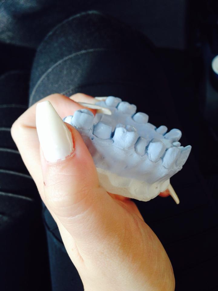Oana Racovita a invata la scoala despre mulajele dentare si le-a aratat asta si prietenilor virtuali