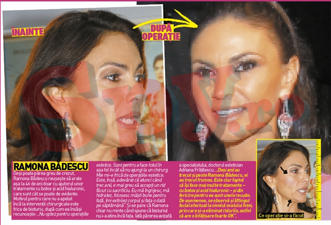 Ramona Badescu are frica de operatiile estetice