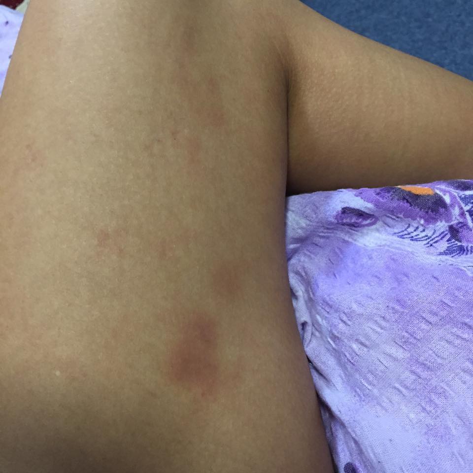 Dansul la bara nu este asa de usor precum pare