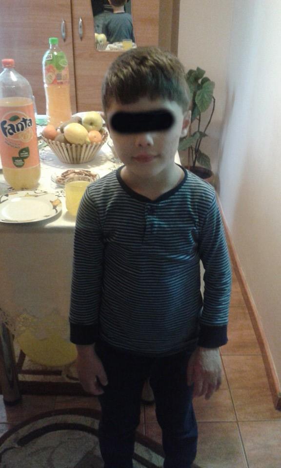 Chiar daca are doar cinci ani, el a trecut deja prin patru operatii