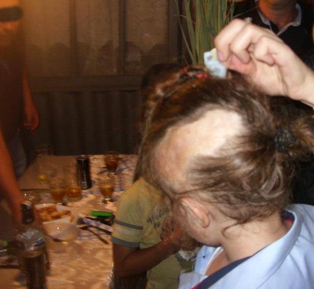 Micutul mai trebuie sa fie supus in lunile ce urmeaza la inca cateva operatii