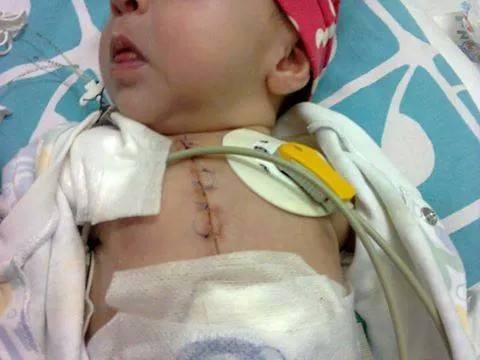 Erica a suferit pana acum doua operatii pe inima