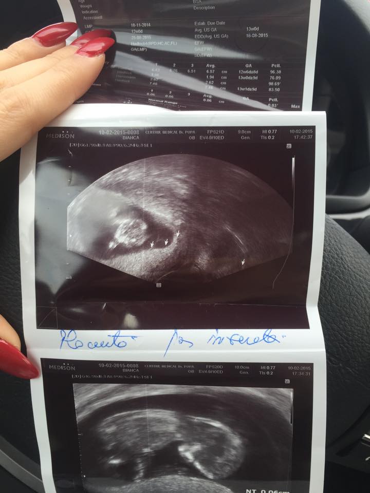 Frumoasa bruneta de abia astepata sa ajunga la ecografie