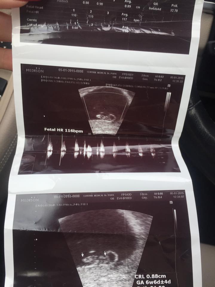 Cei doi vor avea un baietel