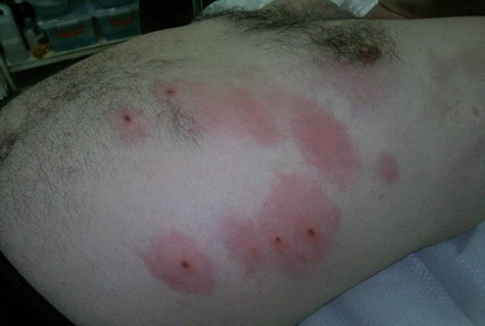 Capusele pun in pericol si sanatatea omului, nu doar cea a cainelui