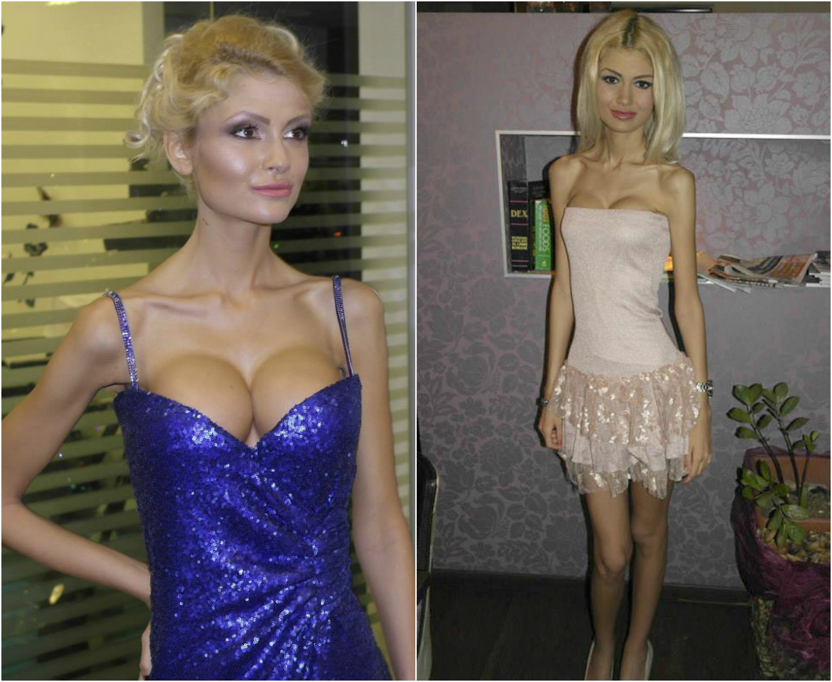 Flavia cântărea cu cinci ani de zile în urmă doar 35 de kilograme