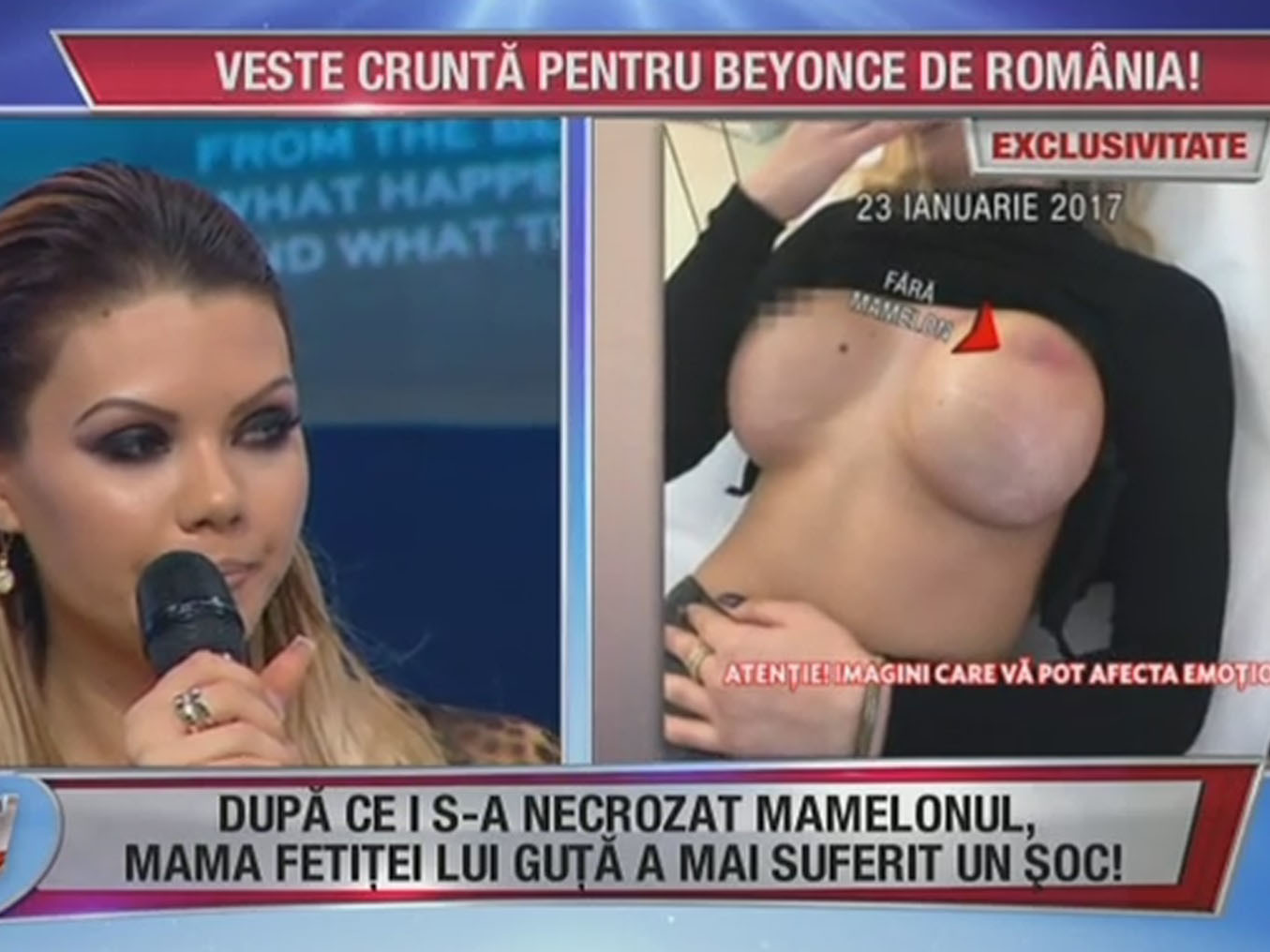 Beyonce are mari probleme de sanatate