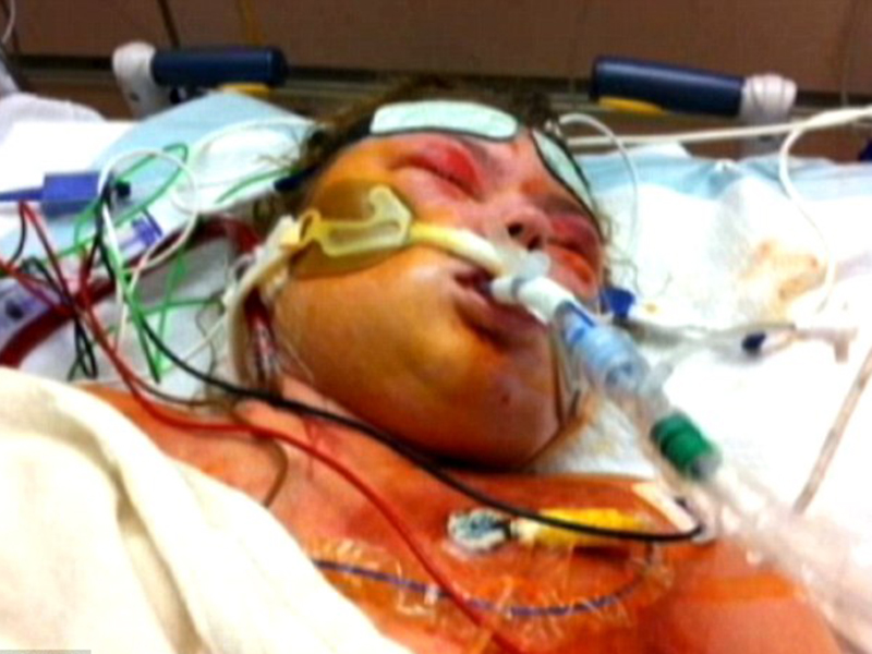 Tragedia unei tinere de 18 ani! De la o răceală a ajuns să nu mai aibă picioare şi să lupte pentru supravieţuire!