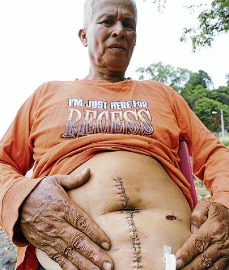 A fost la un pas de moarte după ce un peşte de jumătate de tona i s-a înfipt în stomac! Află cum a fost posibil aşa ceva!