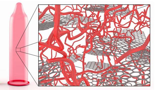proiect, prezervativ