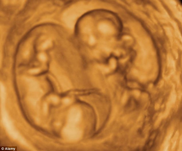 Sarcina multifetală apare atunci când un singur spermatozoid şi un singur ovul se combină, dar apoi se împărte în doi embrioni, formând gemeni identici