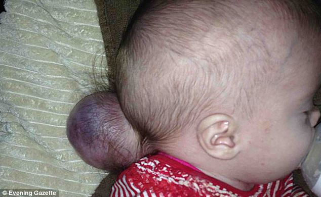Medicii au crezut ca bebelusul nu va ajunge nici macar sa se nasca