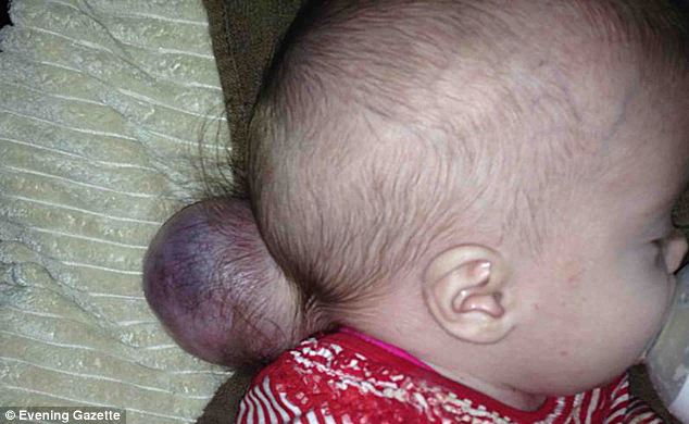 Medicii au crezut ca bebelusul nu va ajunge nici macar sa se nasca