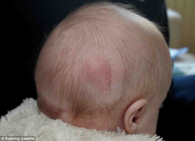 Micuta este in afara oricarui pericol, dupa ce a fost operata