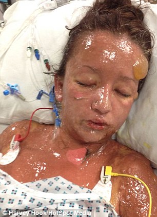 Bubele de pe corpul sau erau de marimea unor mingi de tenis