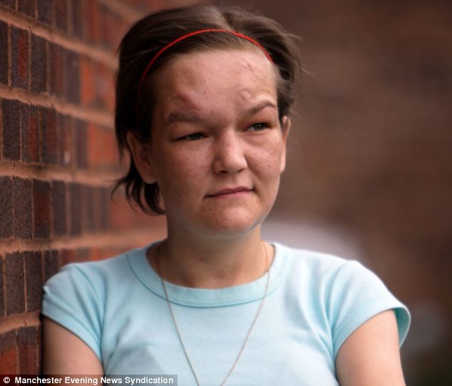 Asa arata dupa ce a devenit dependenta de droguri