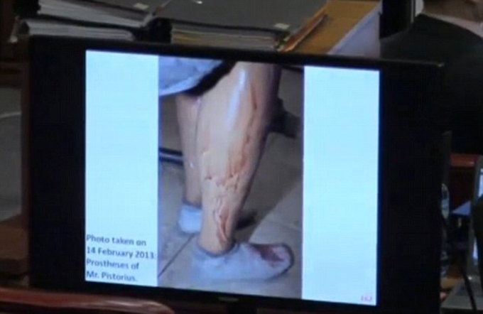 Protezele lui Pistorius sunt plinge de sange