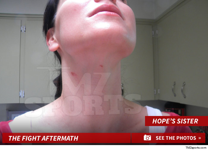 Sora lui Hope Solo a fost si ea agresata cu o coada de matura (sursa foto: TMZ Sports)