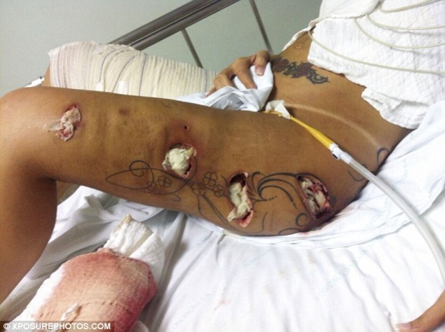 Tanara a trecut prin chinuri groaznice, dupa ce substantele i-au macinat muschii