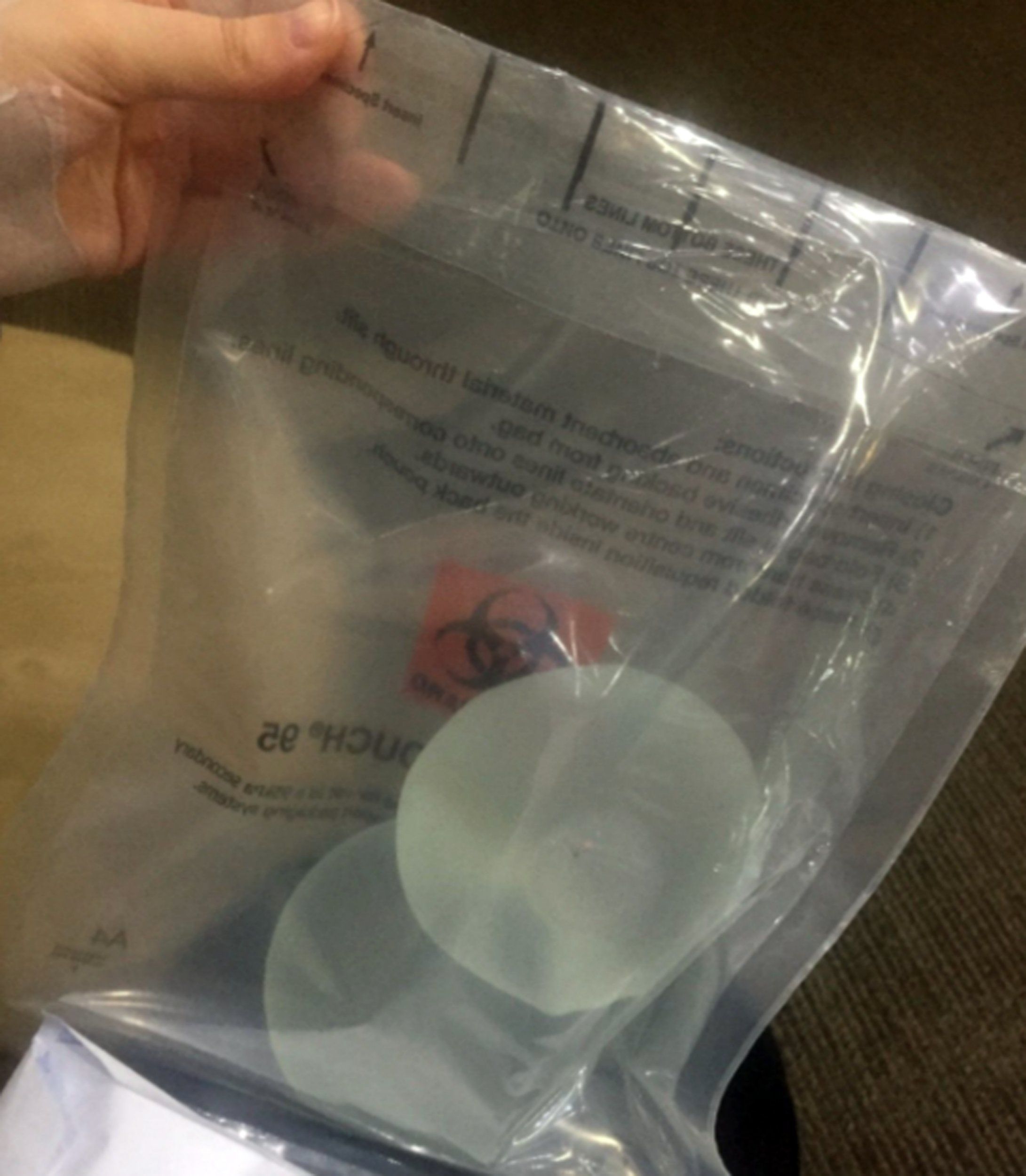 Femeia şi-a scos implanturile la licitaţie