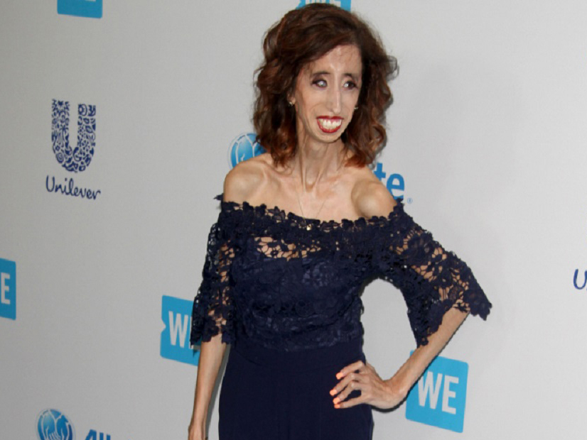 Lizzie are acum 28 de ani.