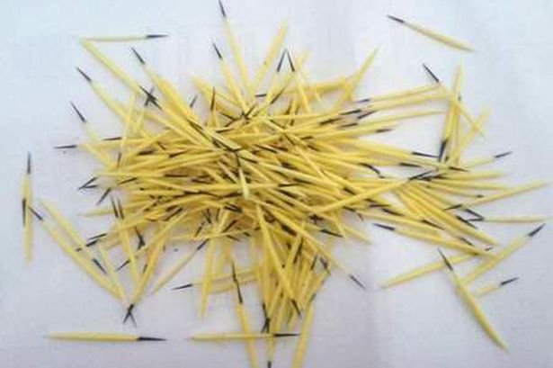 Medicii au scos peste 200 de ace din capul femeii