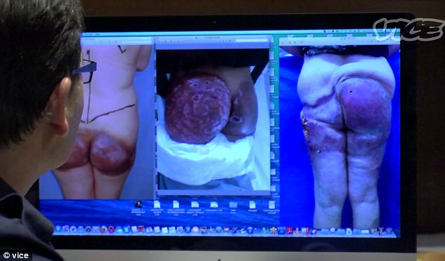 Fundul Oscarinei Busse arata ingrozitor cand a intrat pe mainile unui chirurg