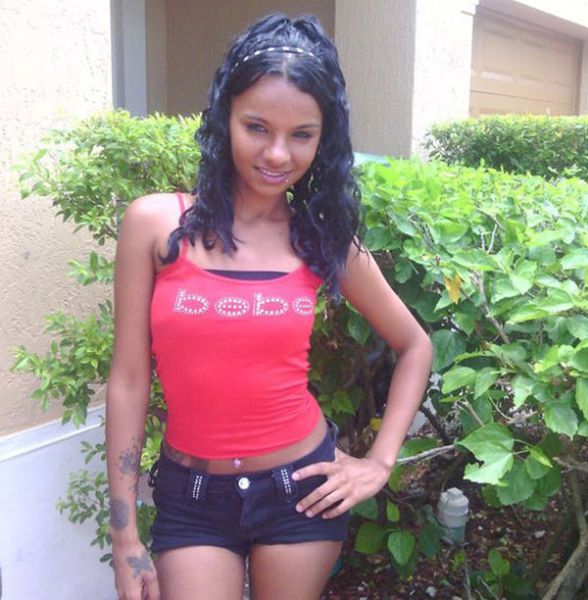 Asa arata inainte sa isi puna implanturi