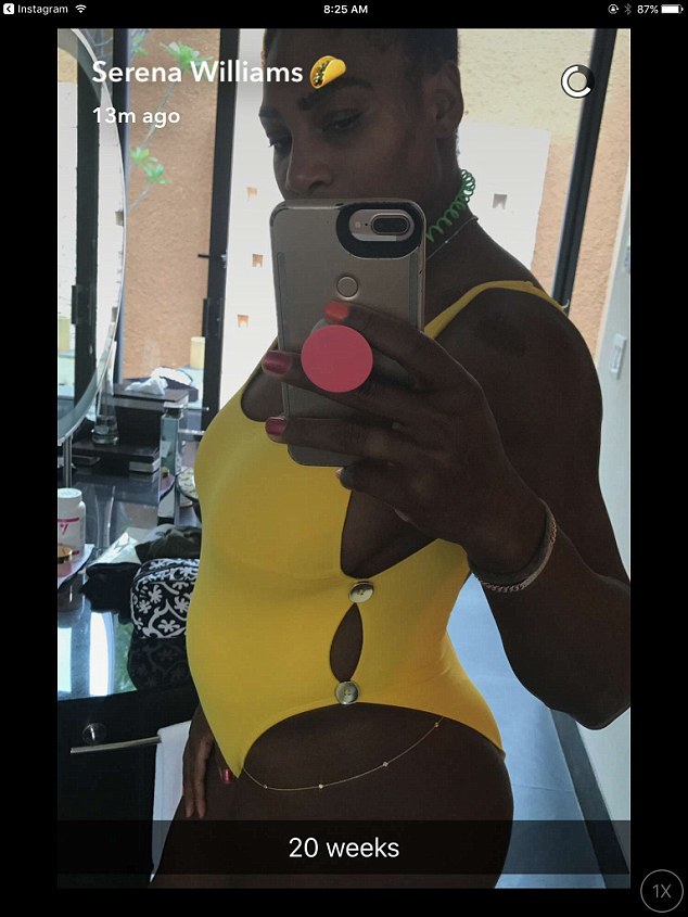 Serena Williams este însărcinată cu primul ei copil