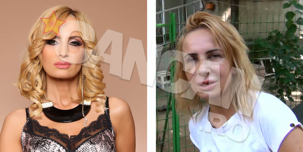 Daniela Gyorfi este inca de nerecunoscut dupa operatia complexa pe care a suferit-o de curand