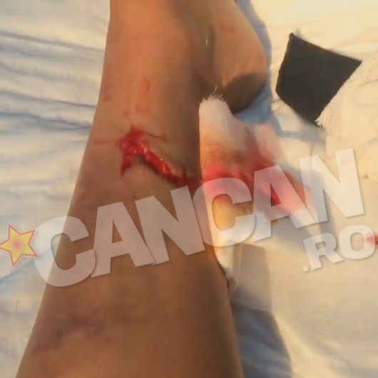 Bianca s-a ranit infiorator la picior in urma cu doua saptamani