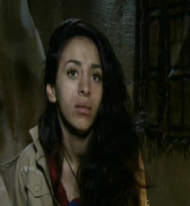 Ruby a avut probleme cu acneea