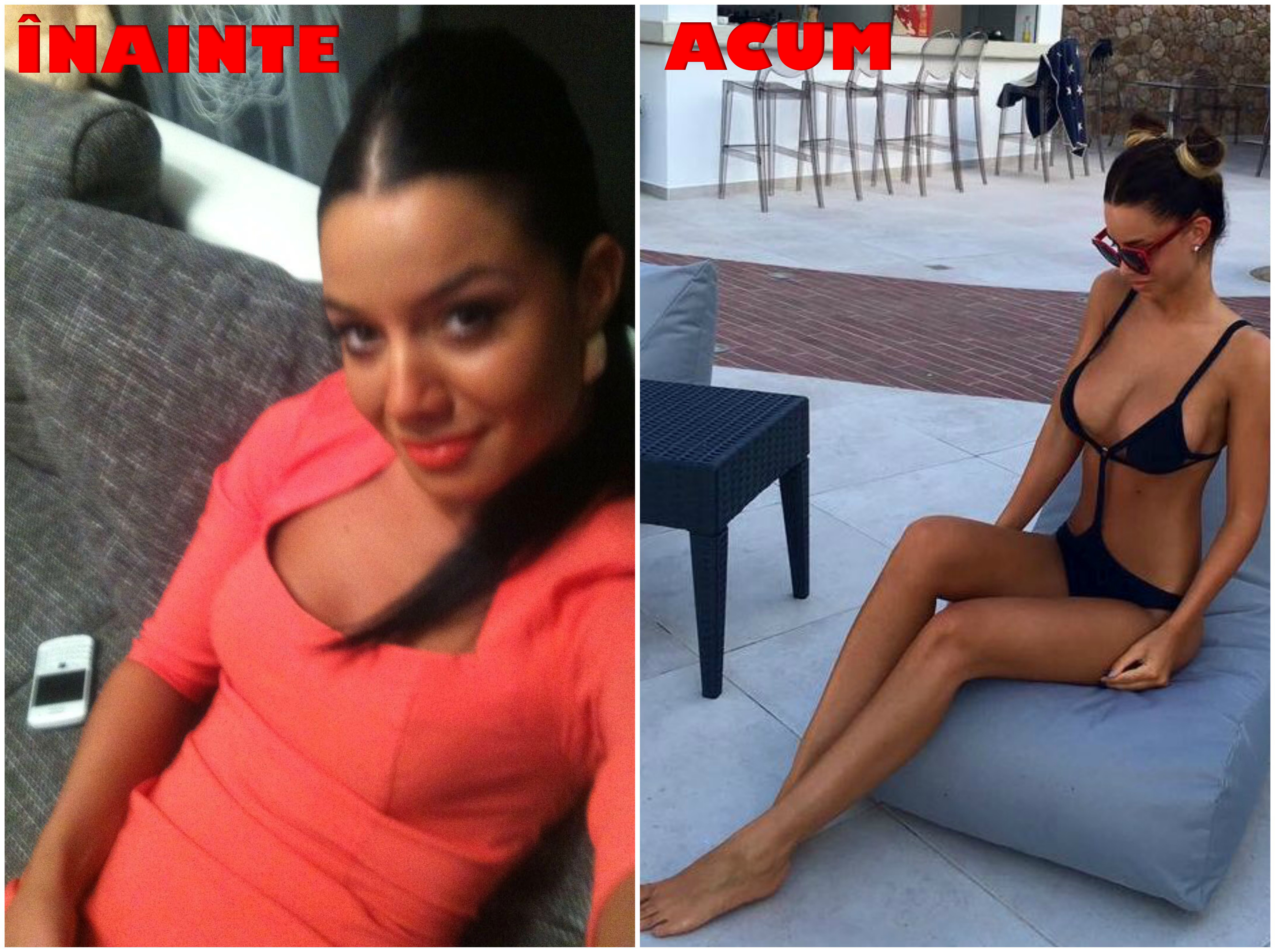 Intervenţia chirurgicală realizată la nivelul bustului este mai mult decât evidentă, iar Mumuşica pare să fie foarte mulţumită de rezultate.