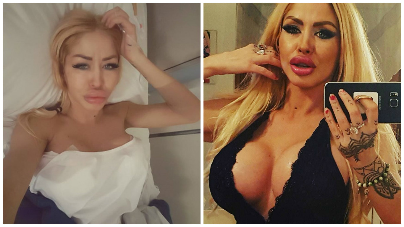 În prima imagine o puteţi vedea pe Eva Kent imediat după operaţie, iar în cea de-a doua, vedeţi cum arată acum.