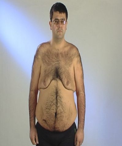 Aşa arăta bărbatul după ce a slăbit 120 de kilograme.