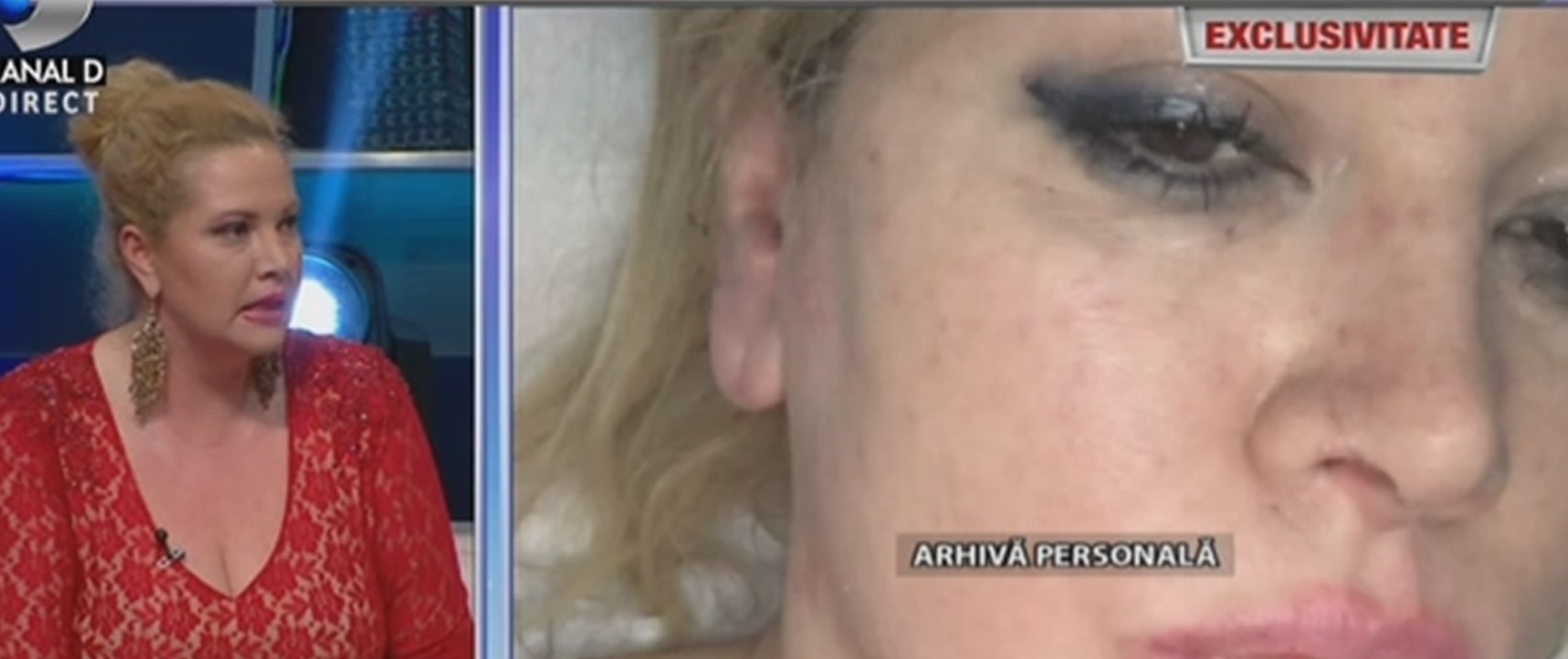 Oana Lis a ajuns de urgenţă la spital