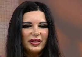 Marinela Niţu este desfigurată din cauza operaţiilor estetice