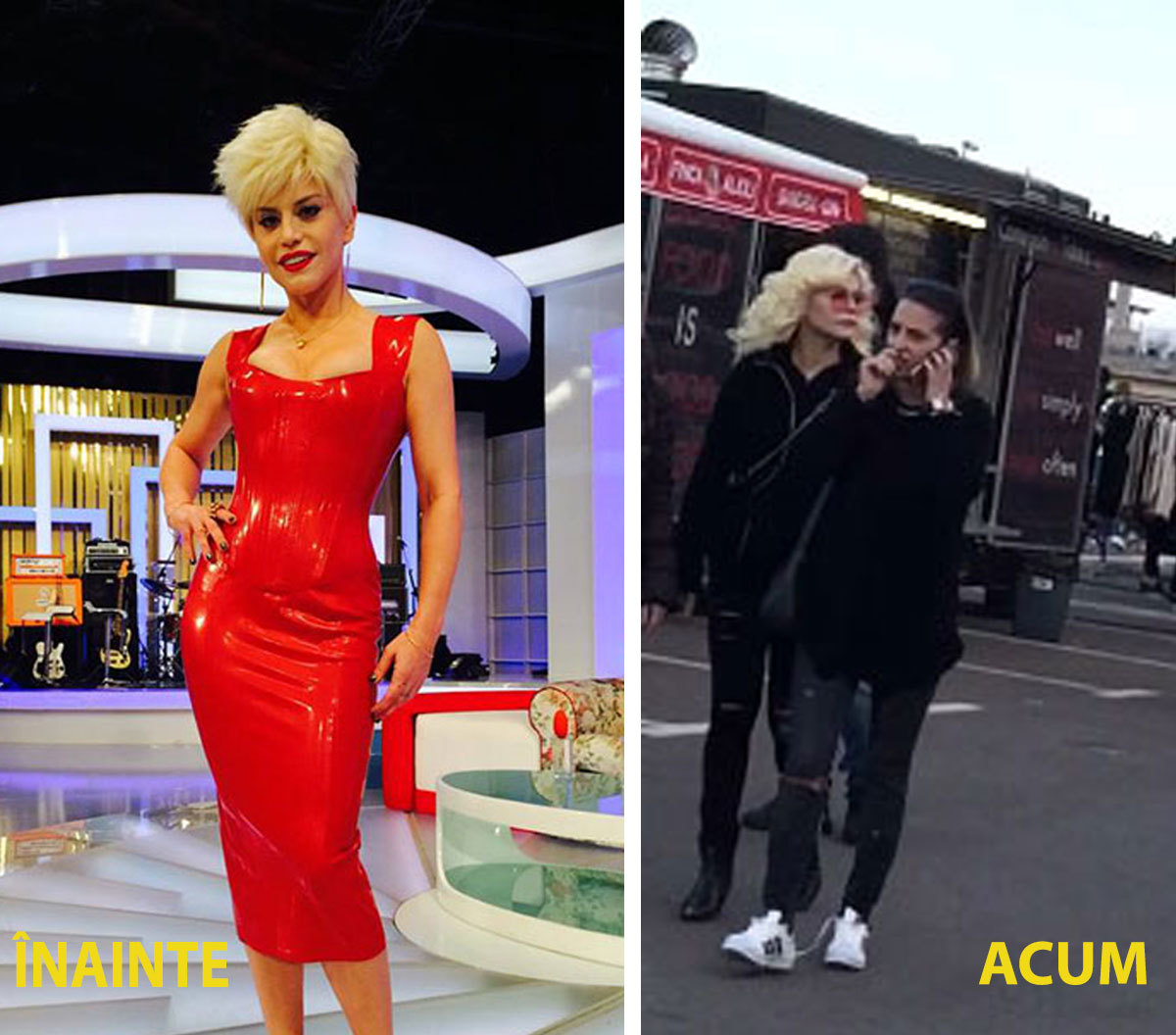 Loredana are o multitudine de intervenţii la nivelul feţei