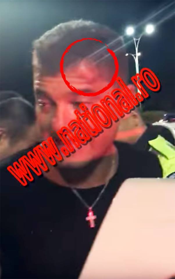 Boureanu are urme pe frunte de la contactul cu asfaltul
