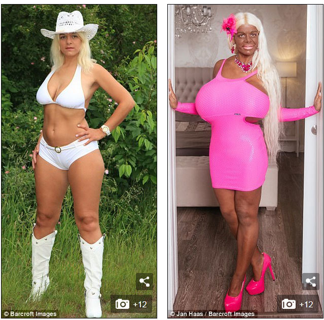 Aşa arătat Martina înainte de operaţii