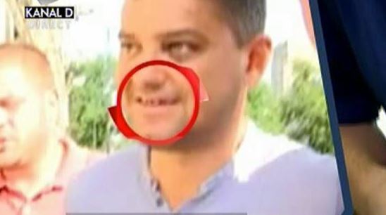 Cristian Boureanu are dantura distrusă, după pumnul primit de la poliţist