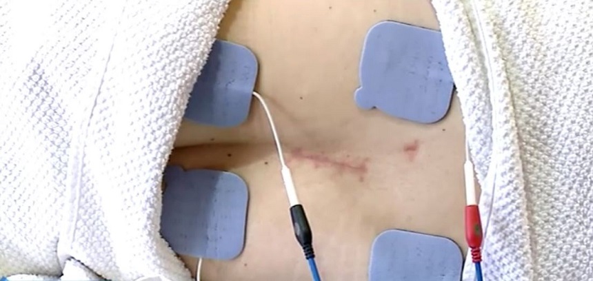 Operaţia la coloană a Monicăi Anghel