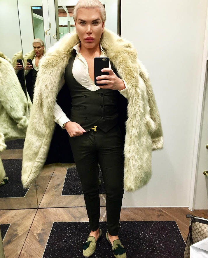 Aşa arată acum Rodrigo Alves