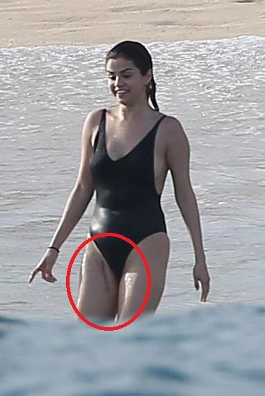 Selena Gomez a apărut cu o cicatrice în apropierea zonei intime
