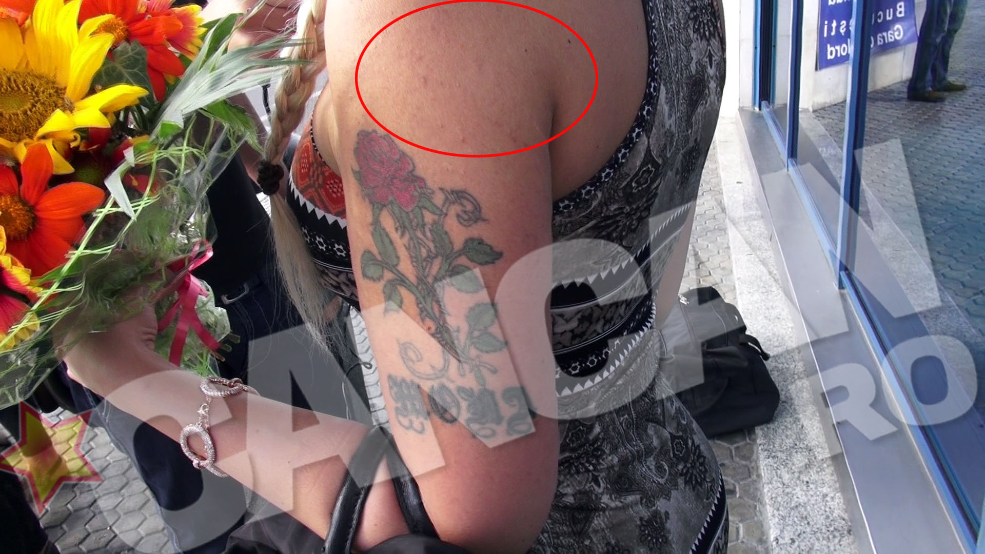 Alexandra Harra are mari probleme cu acneea si pe corp