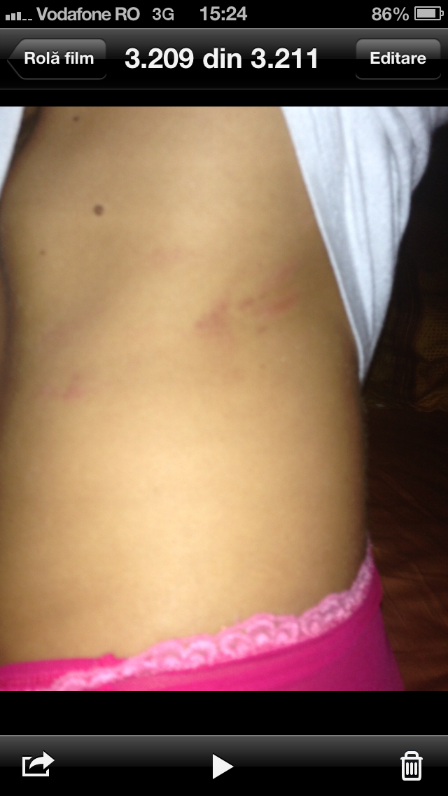 In timpul incaierarii, Bianca a fost lovita si in zona abdominala