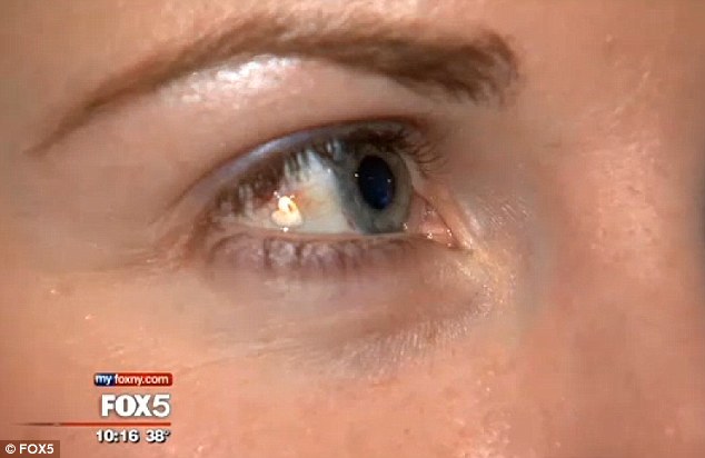 implant in ochi