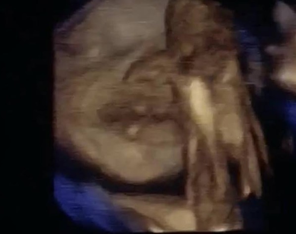 Prima poză cu viitoarea fetiţă a Mădălinei Ghenea