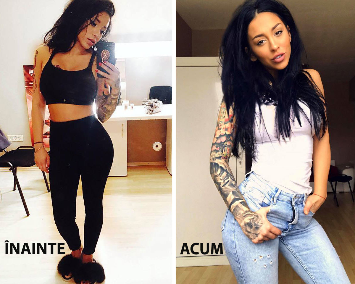 Ruby şi-a scos acidul hialuronic din buze