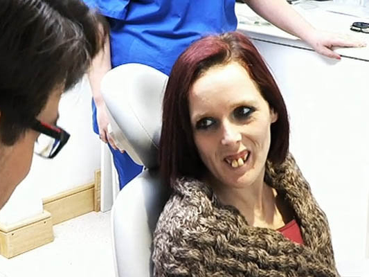 Image result for femeia cu cei mai urati dinti din lume